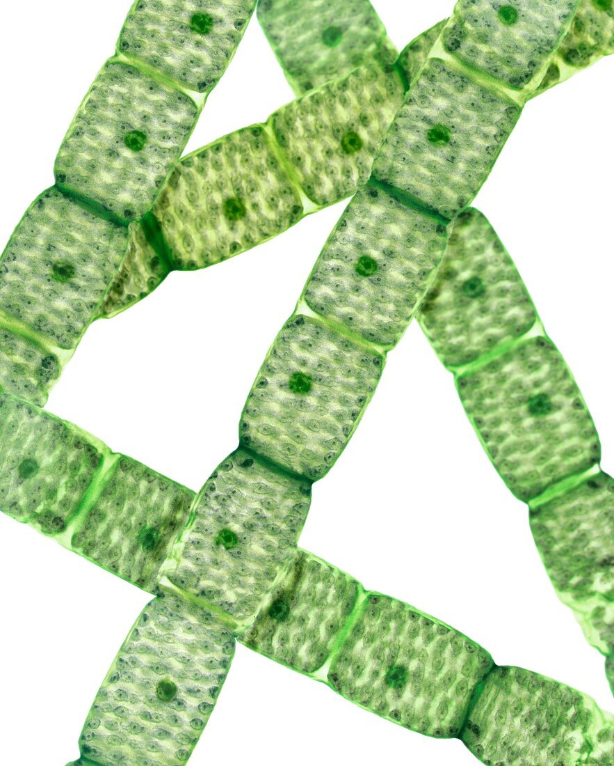 Spirogyra algae,light micrograph