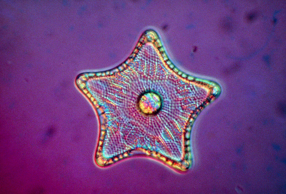 Diatom alga,Triceratium antediluvium
