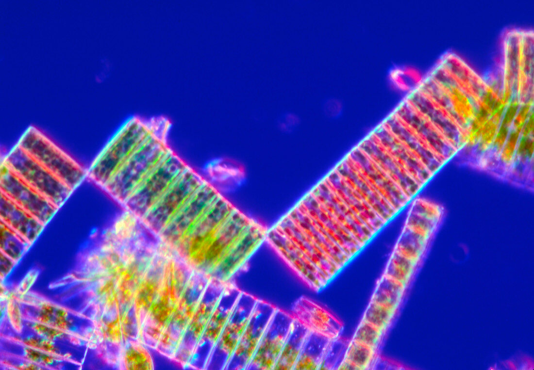 LM of the colonial diatom Fragillaria sp