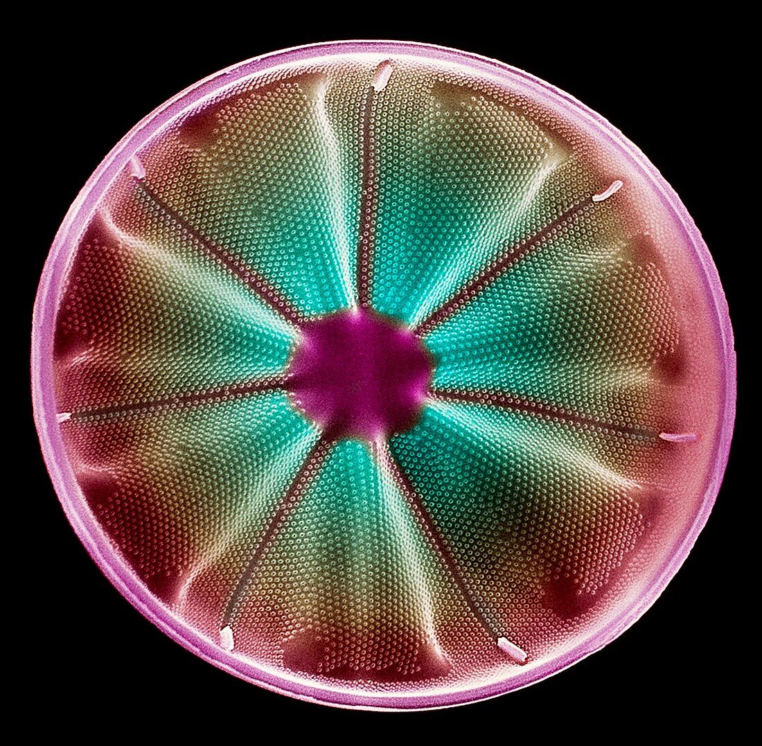 Diatom alga,SEM