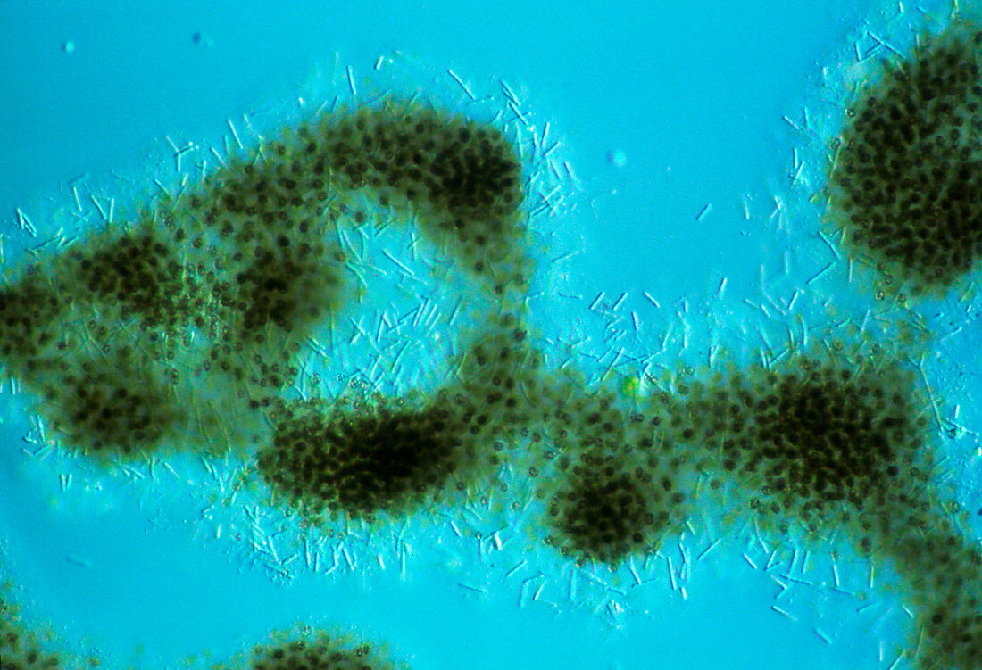 LM of Chlorella surrounded by bacteria