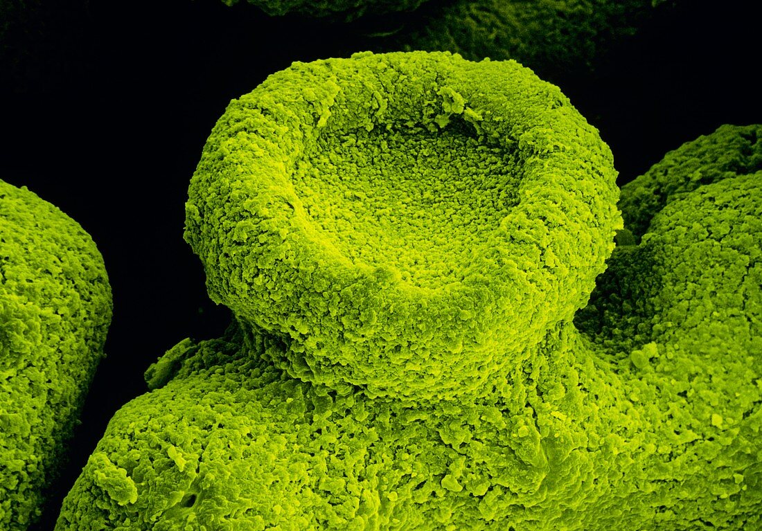SEM of the lichen Xanthoria parietina