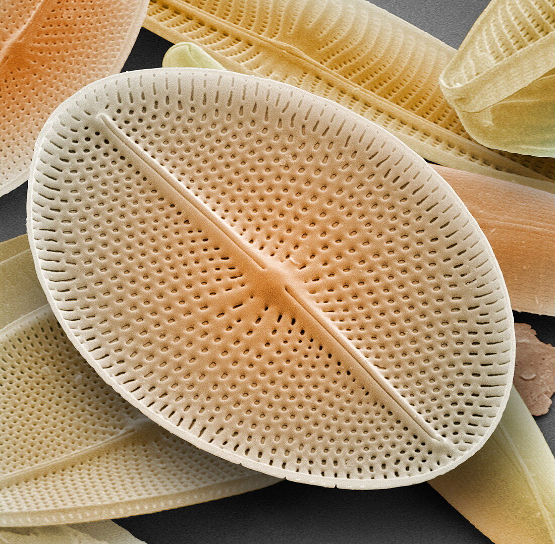 Diatom,SEM