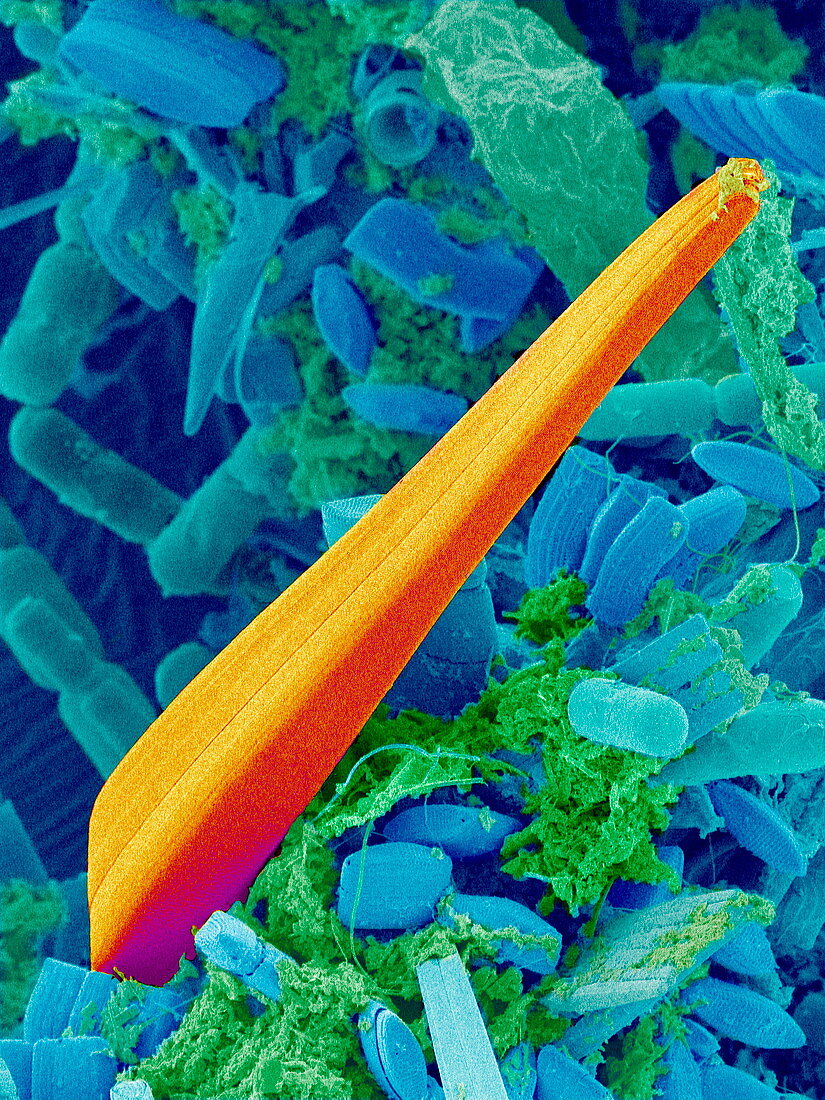 Marine diatom alga,SEM