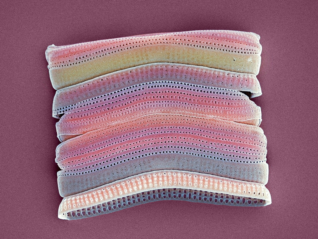 Colonial diatom,SEM