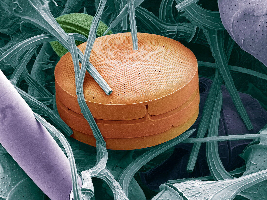 Planktonic diatom alga,SEM