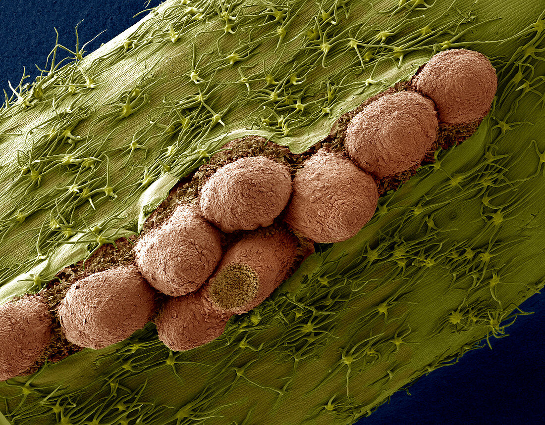 Adventitious roots of ivy,SEM