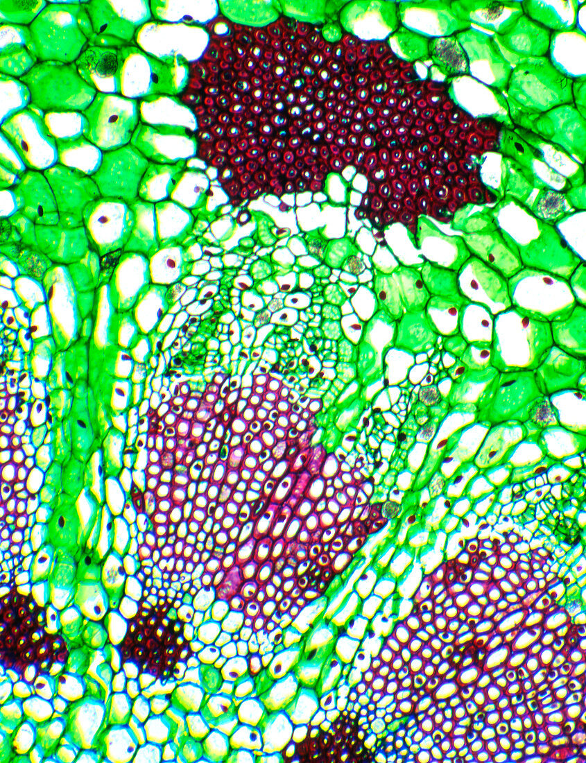 Mistletoe vascular bundle,LM