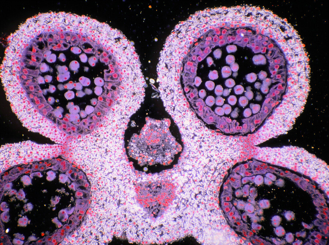 Section through a lily anther with pollen