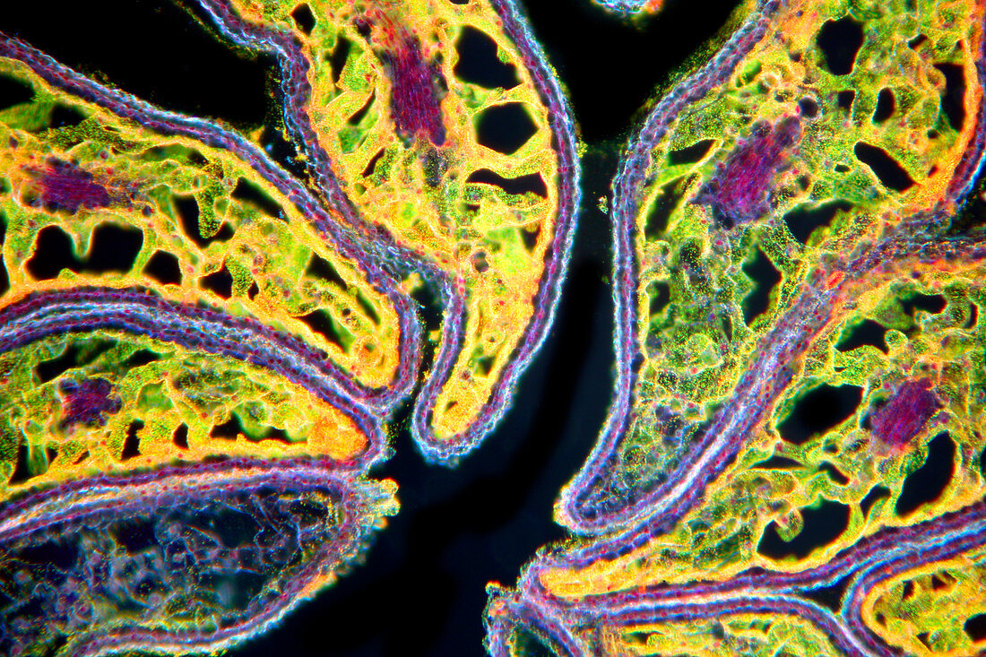 Mature poppy ovary,light micrograph
