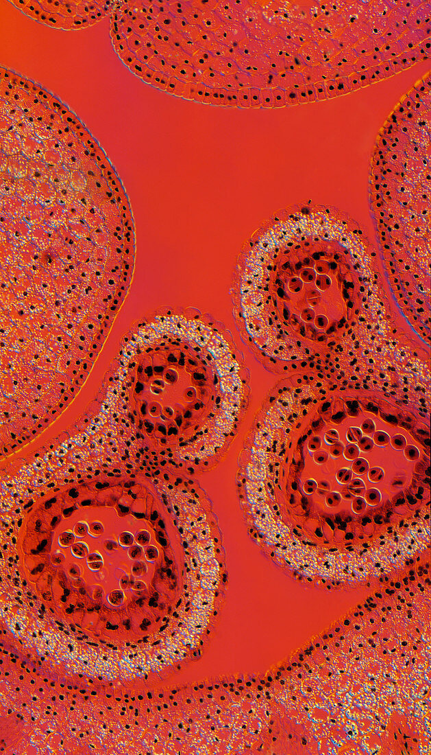 Developing plant seeds,light micrograph