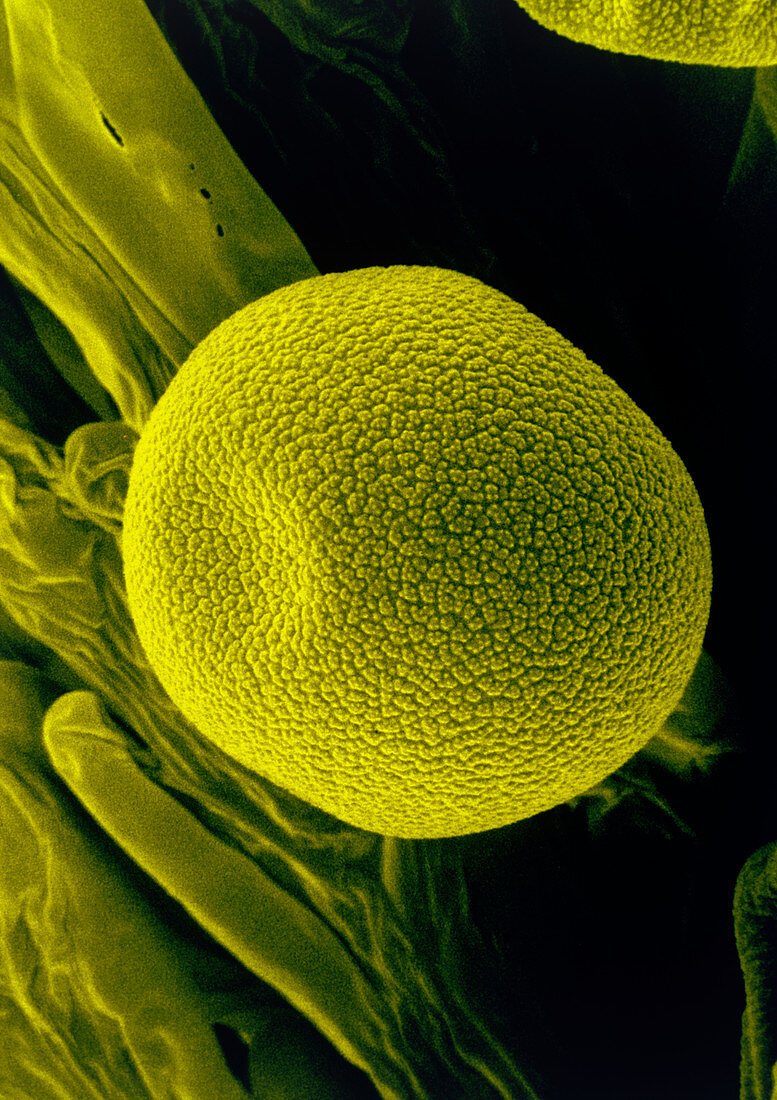 Coloured SEM of pollen grains on stigma