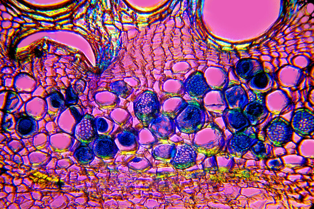 Vascular bundle,light micrograph