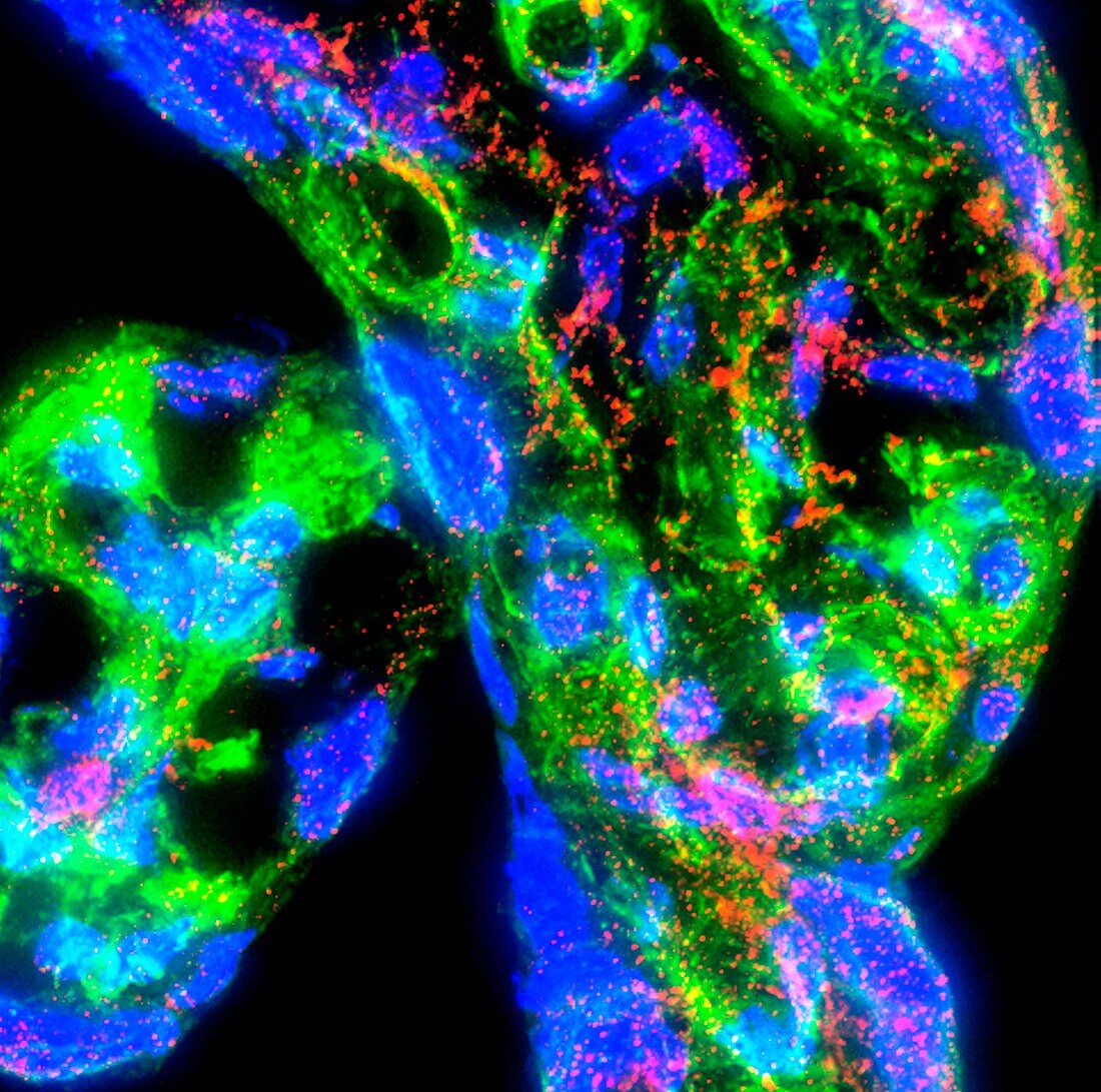 Placental tissue,fluorescence micrograph