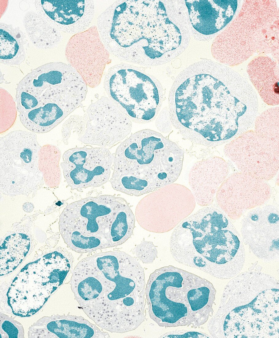 Bone marrow cells,TEM