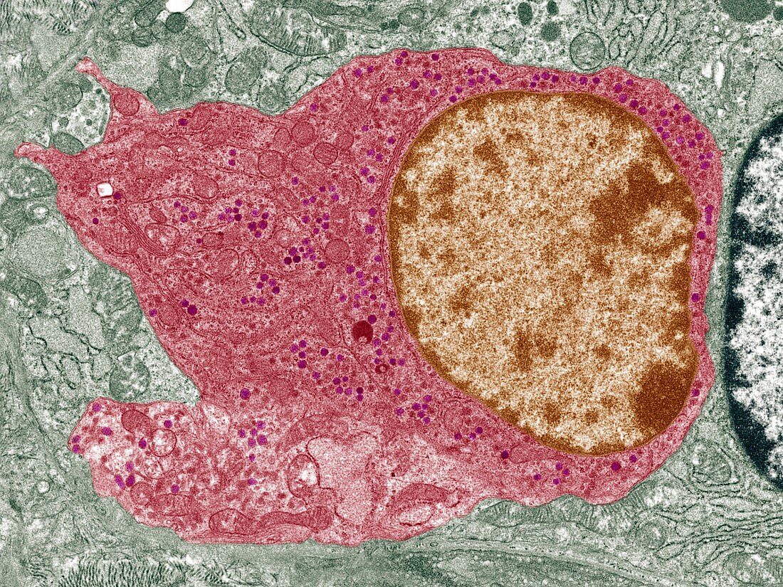 Thyroid parafollicular cell,TEM