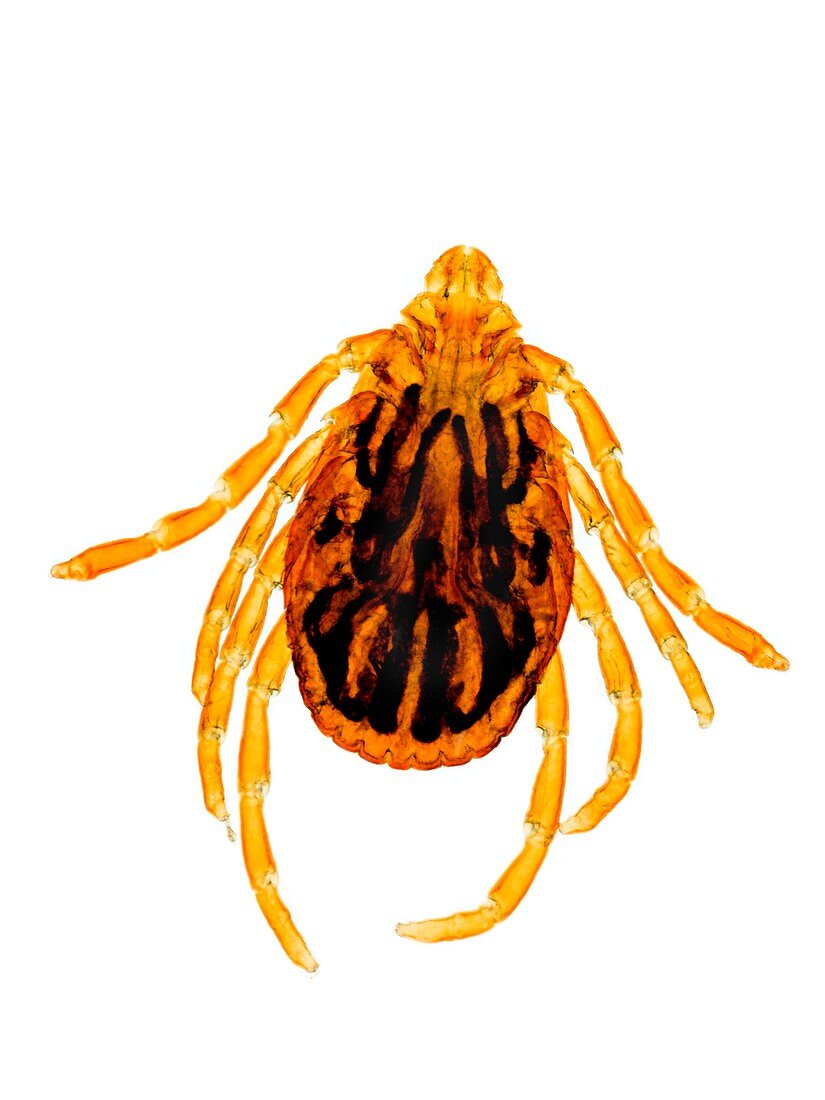 Common sheep tick,light micrograph