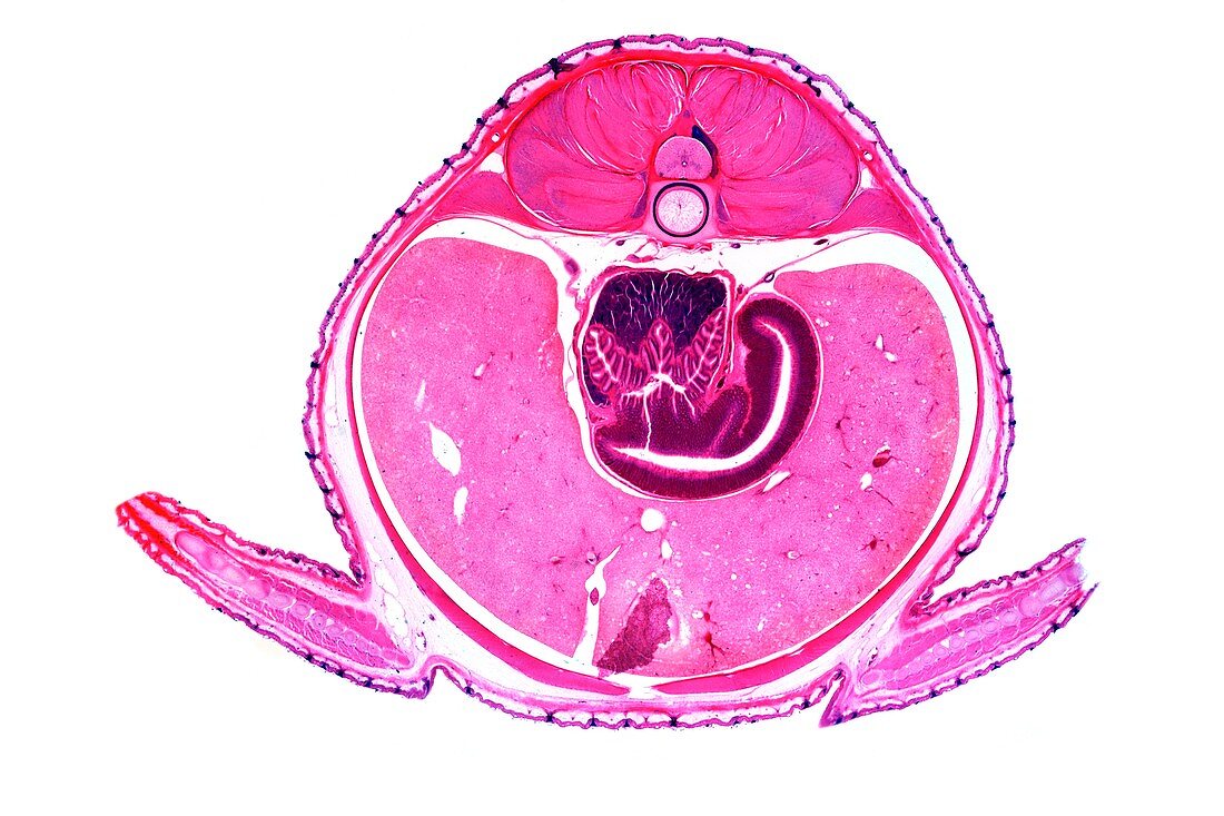 Dogfish liver area,transverse section