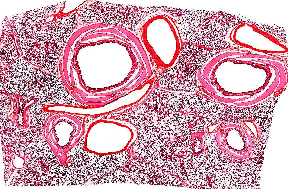 Lung tissue,light micrograph