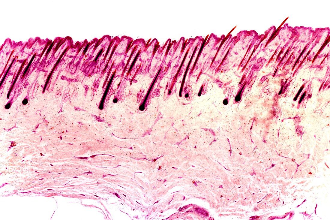 Skin tissue,light micrograph
