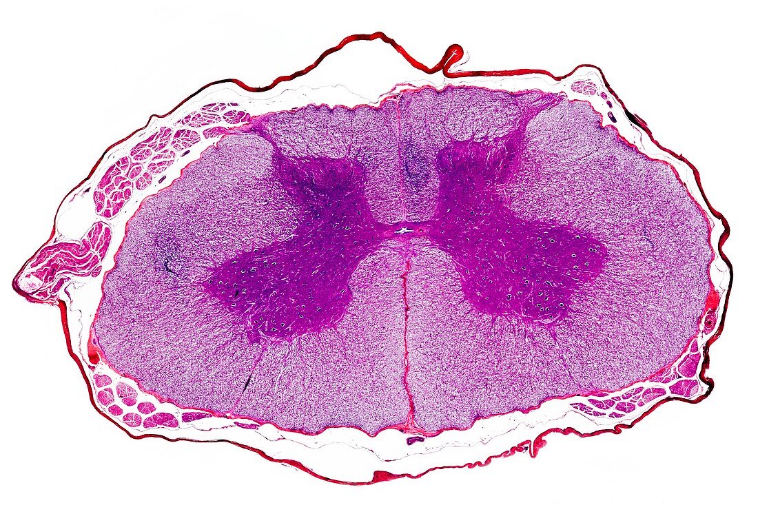 Spinal cord,transverse section