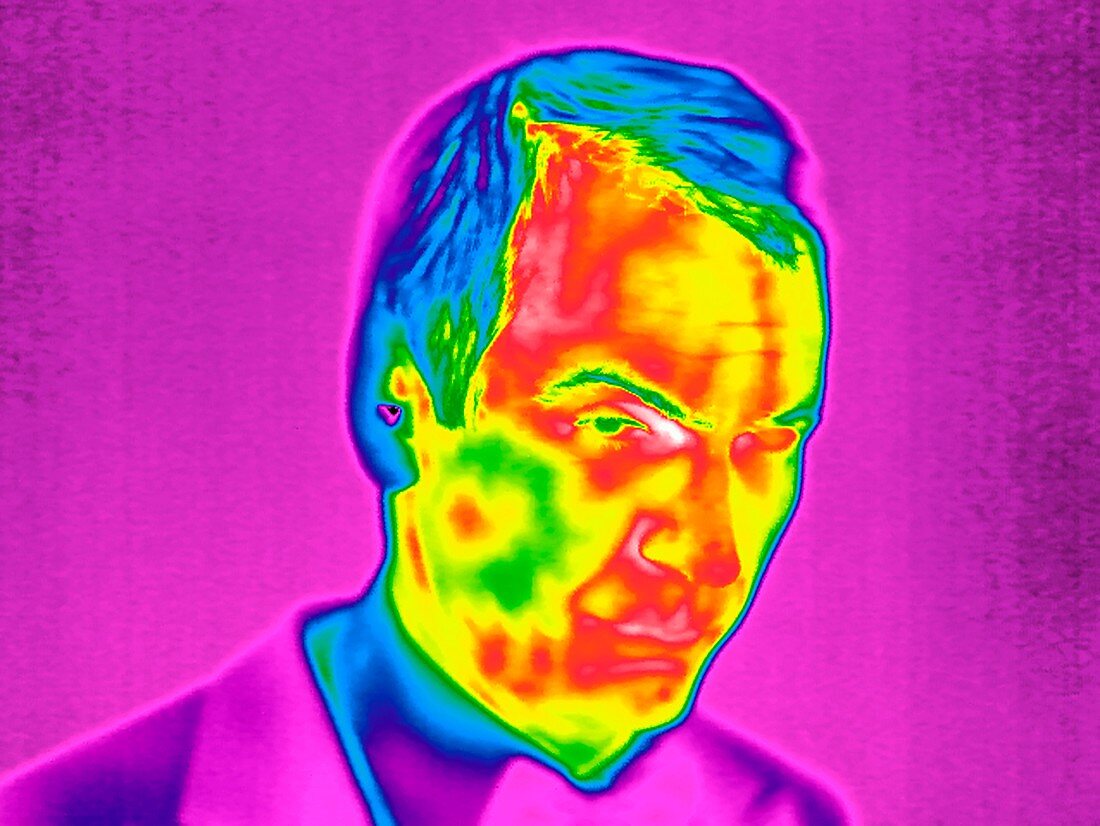 Man's face,thermogram