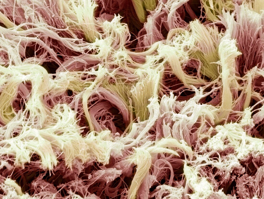 Collagen,SEM