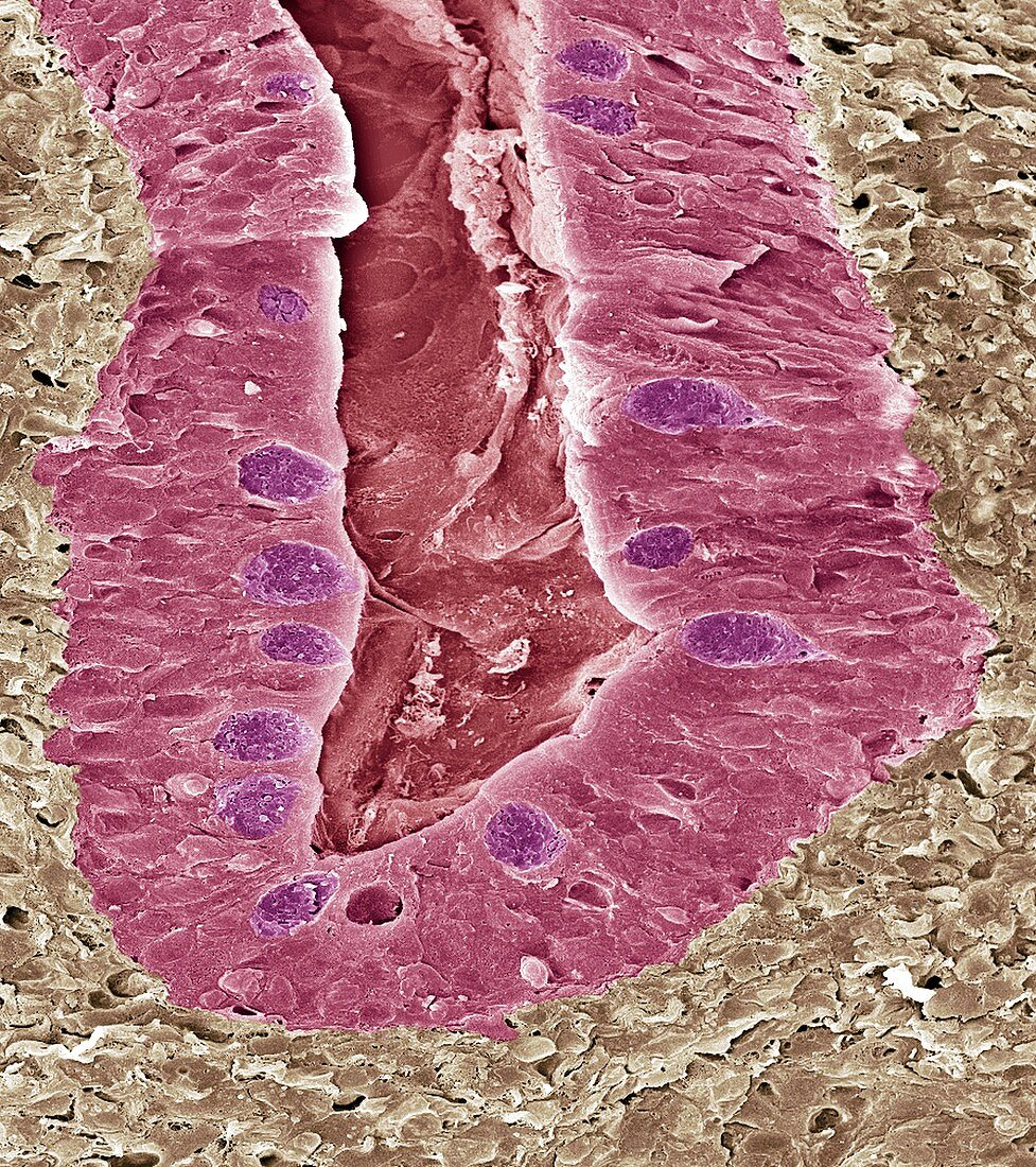 Intestinal lining,SEM