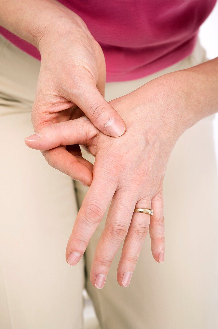 Arthritic hands