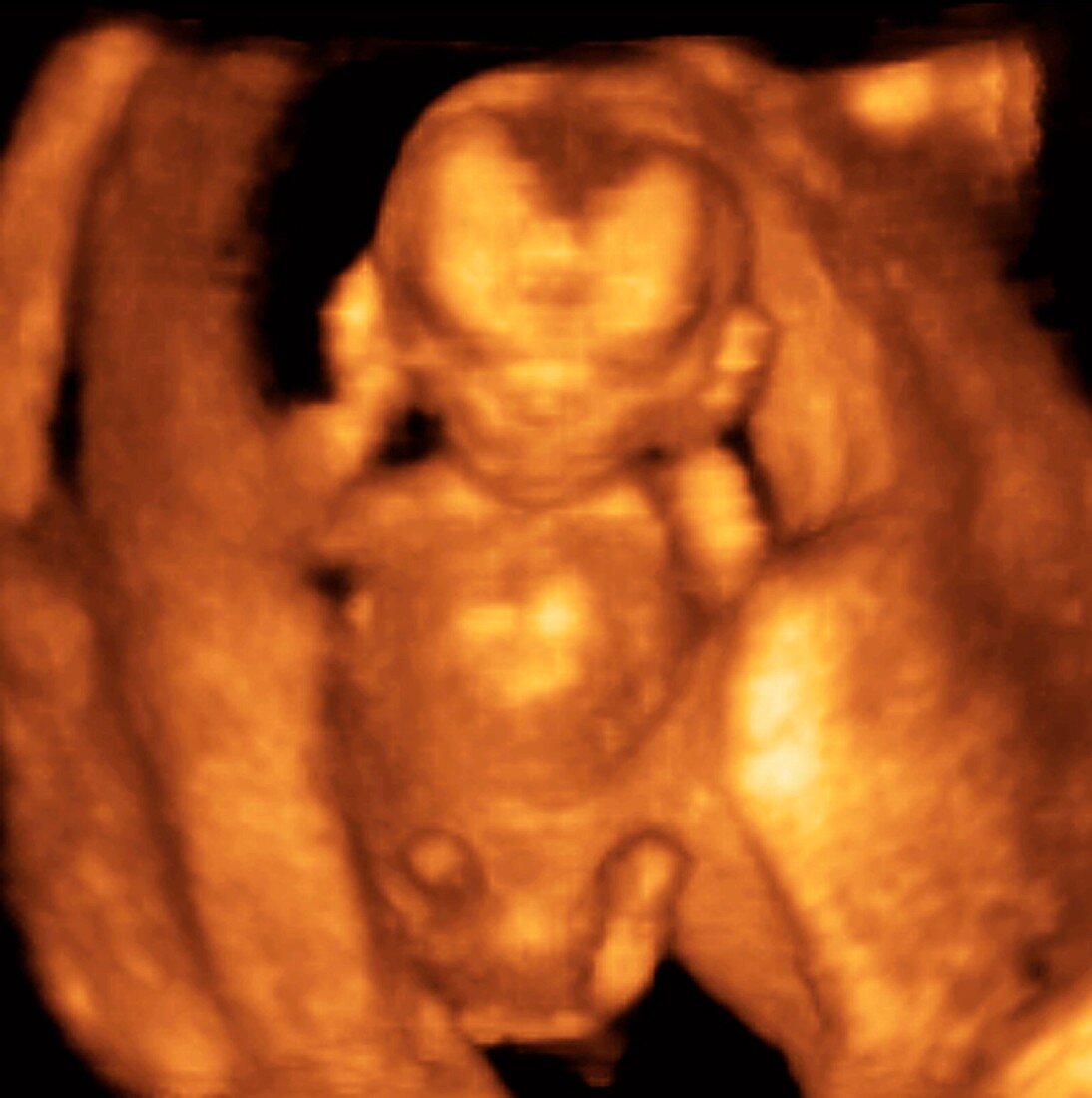 Foetus at 12 weeks,3D ultrasound
