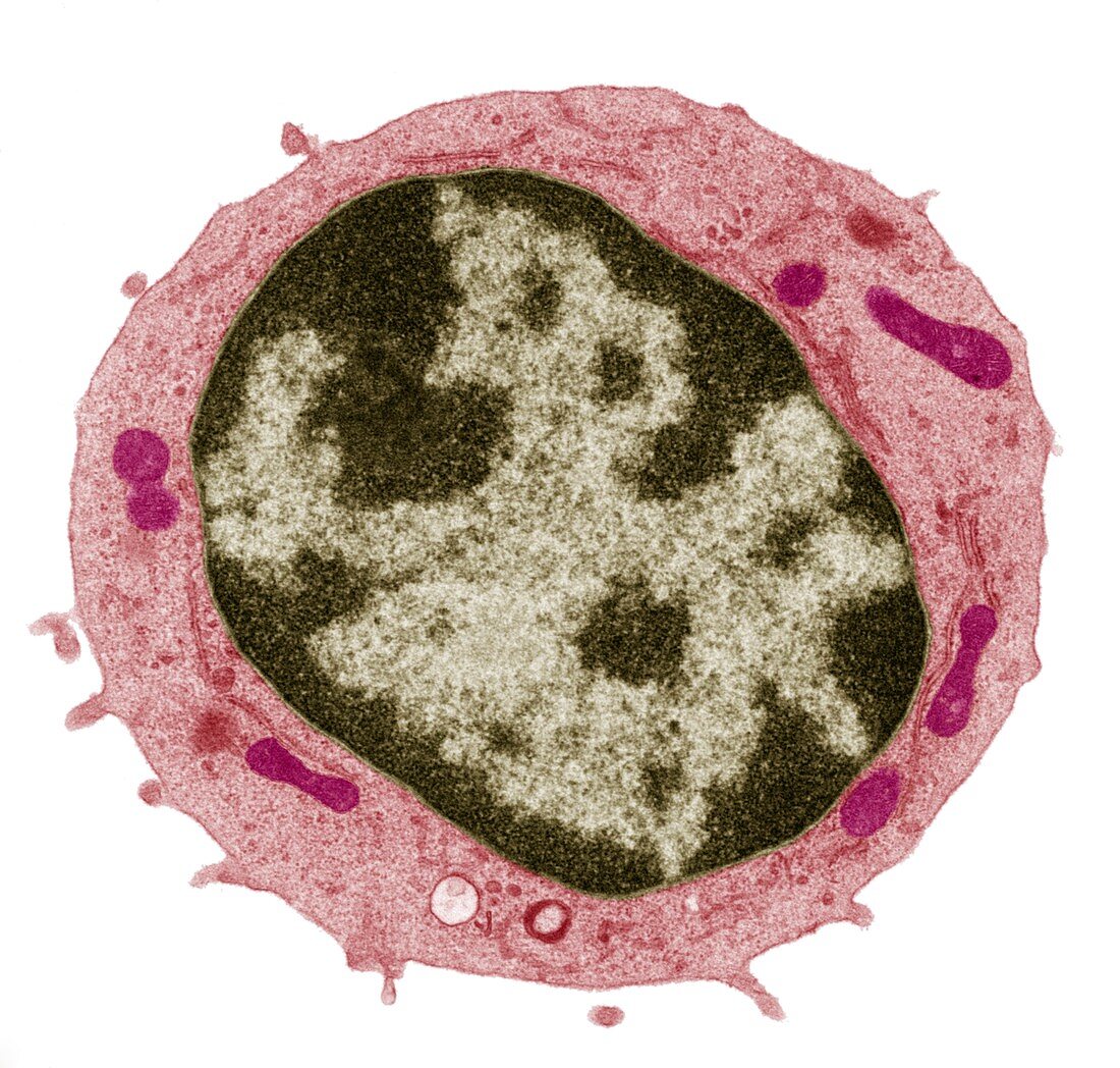 Small lymphocyte,TEM