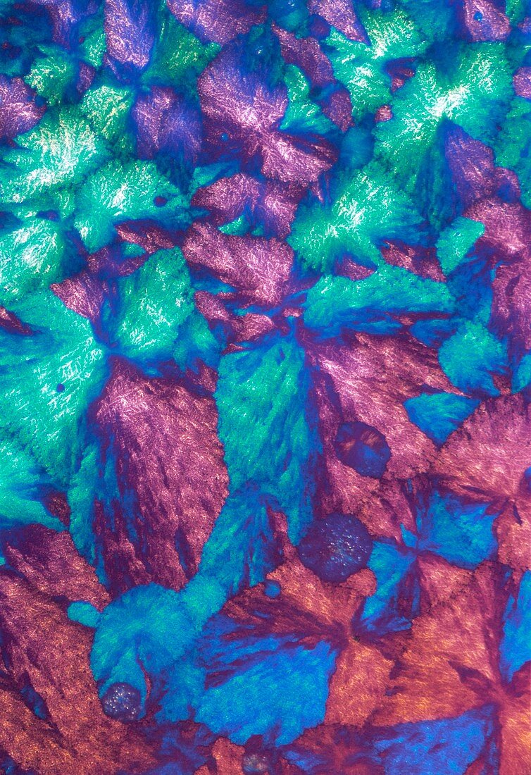 Immunoglobulin crystals,light micrograph