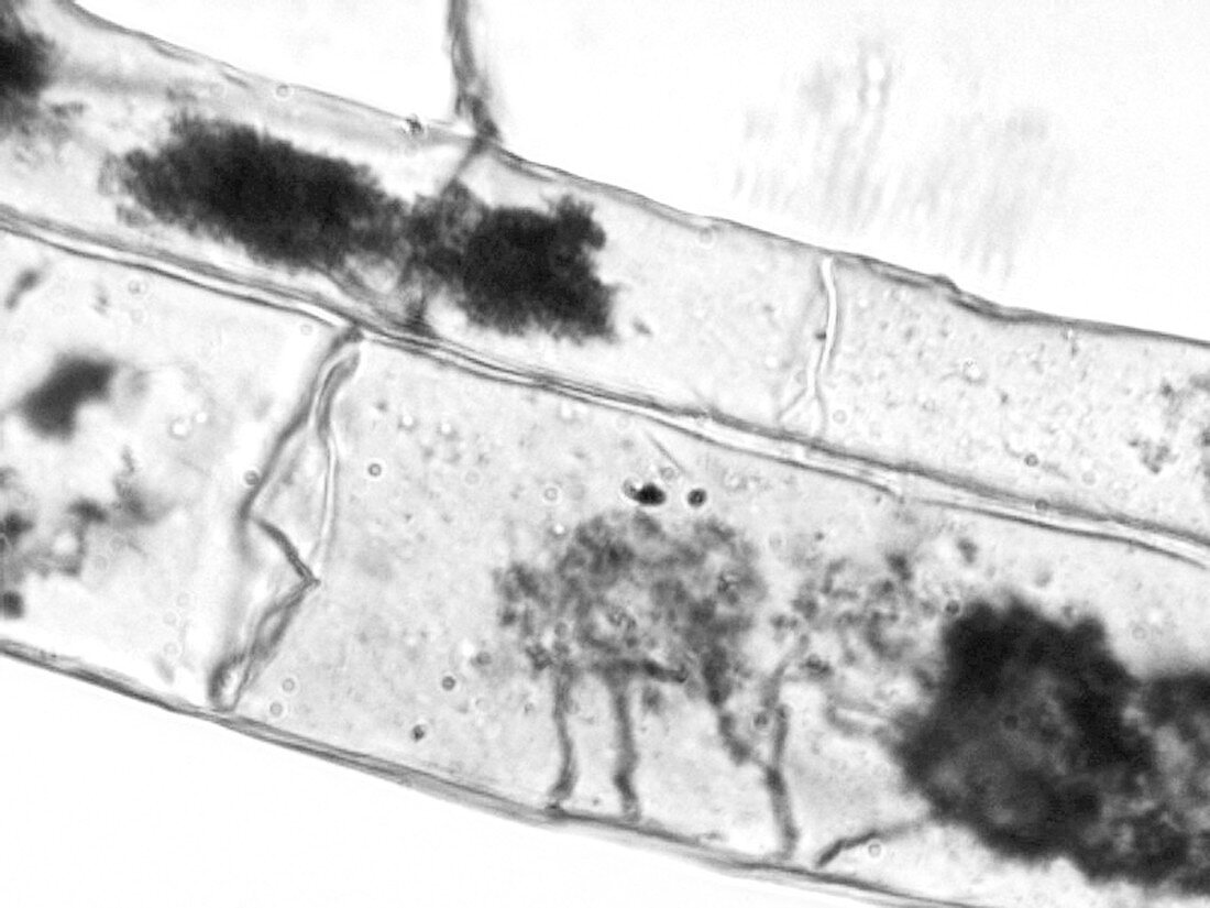 Mycorrhizal root cells
