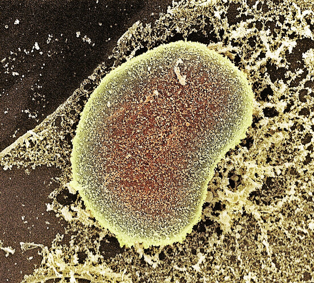 Cell nucleus,SEM