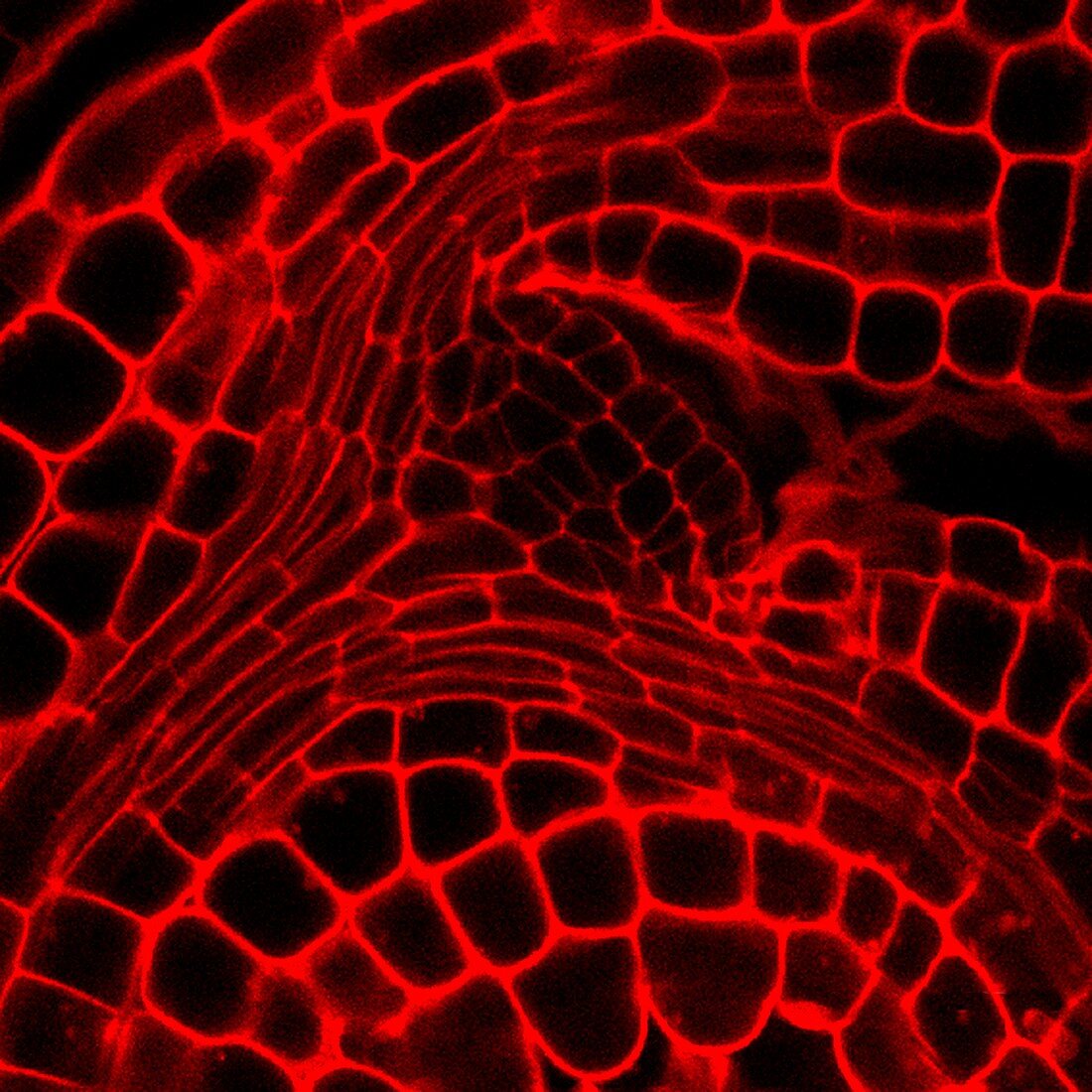 Plant embryo,light micrograph
