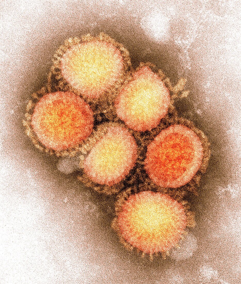 2009 H1N1 swine flu virus,TEM