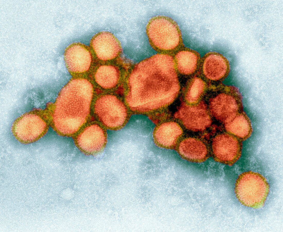 2009 H1N1 swine flu virus,TEM