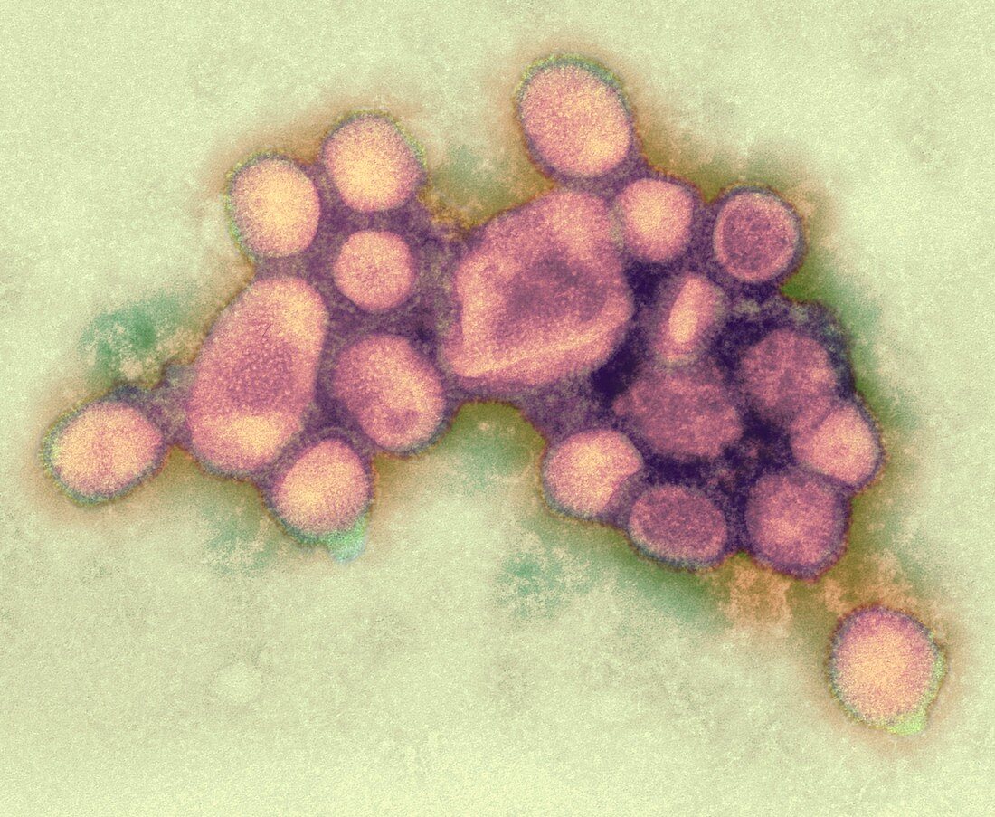 2009 H1N1 swine flu virus,TEM