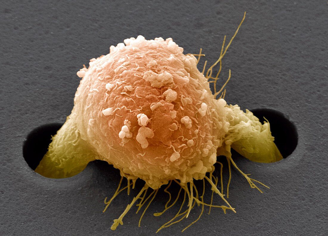 Migrating breast cancer cell,SEM