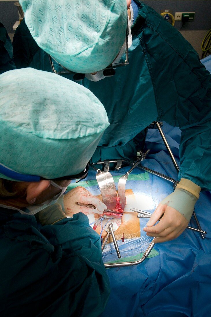 Kidney transplant surgery