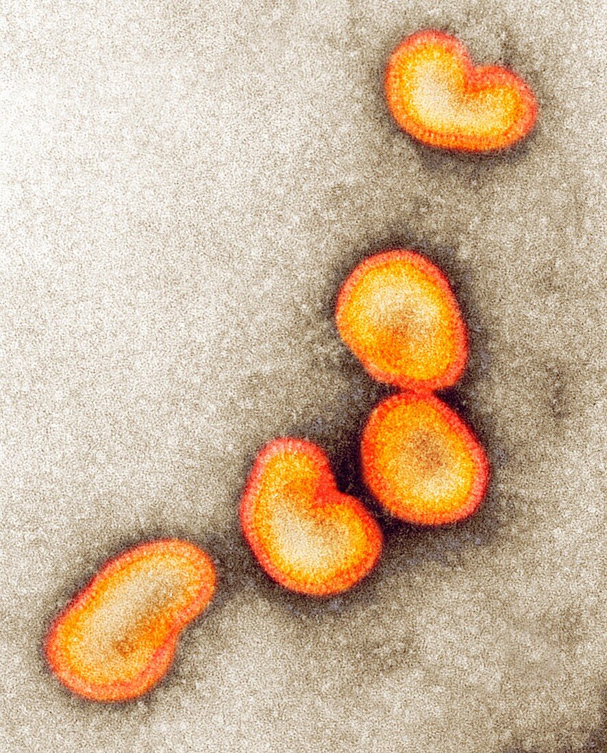 H1N1 Influenza A virus particles,TEM