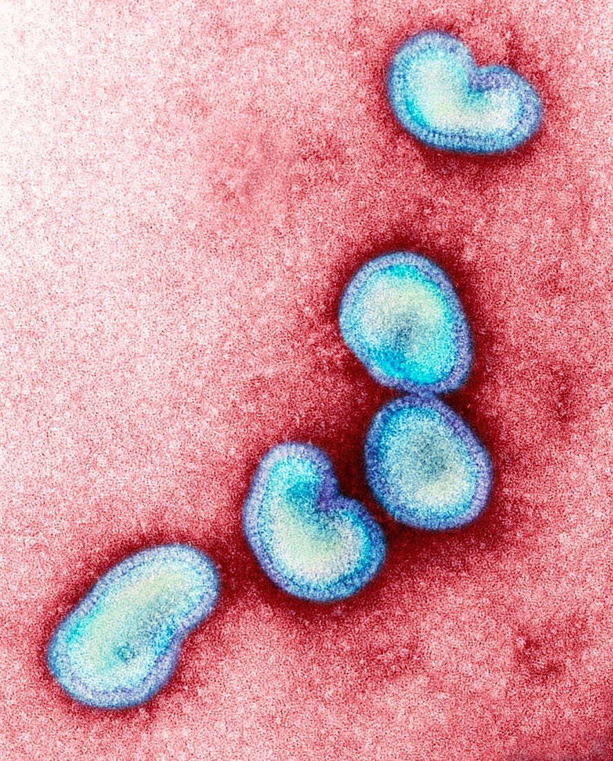 H1N1 Influenza A virus particles,TEM