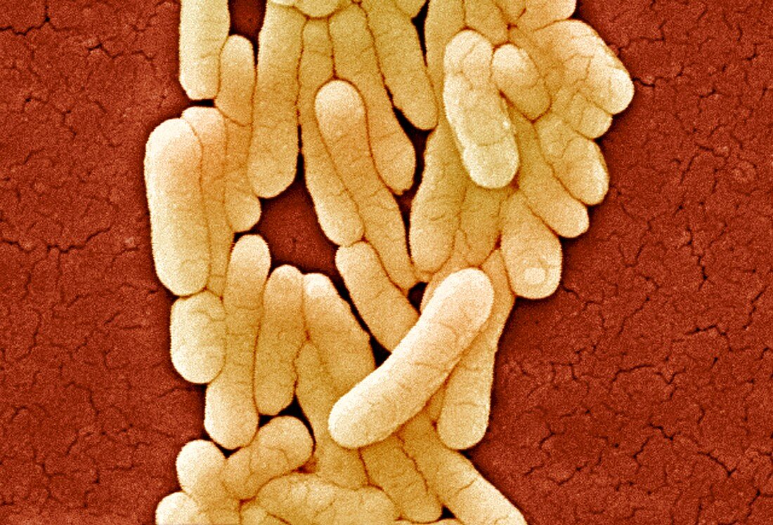 Salmonella typhimurium bacteria,SEM