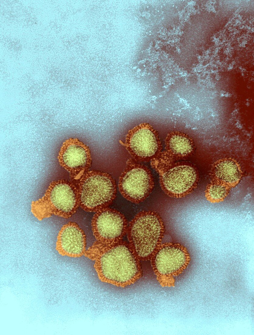 H5N3 influenza A virus particles,TEM