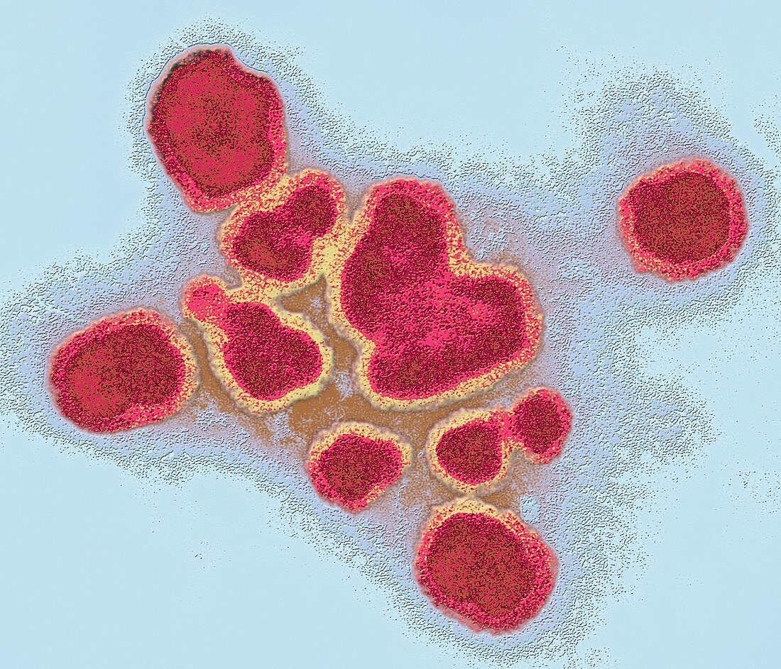 Influenza A virus particles,TEM