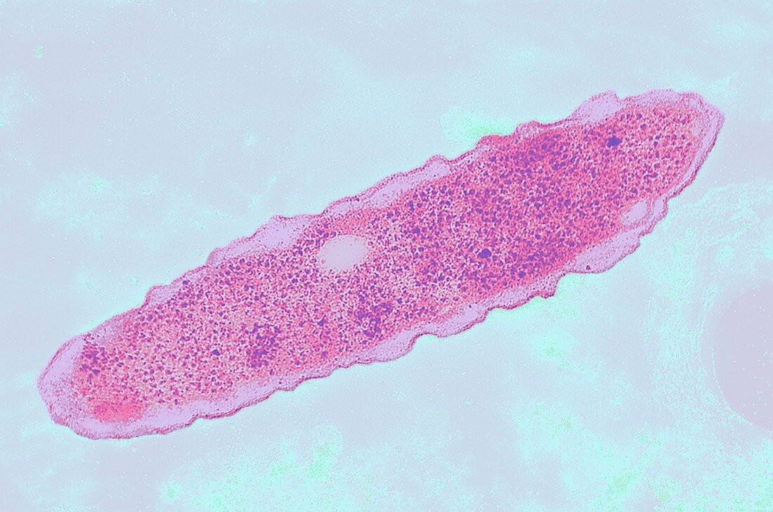 Legionella bacterium,TEM