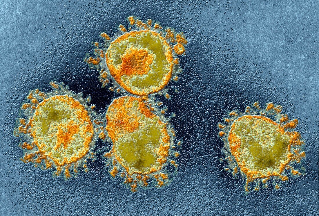 Human coronavirus,TEM