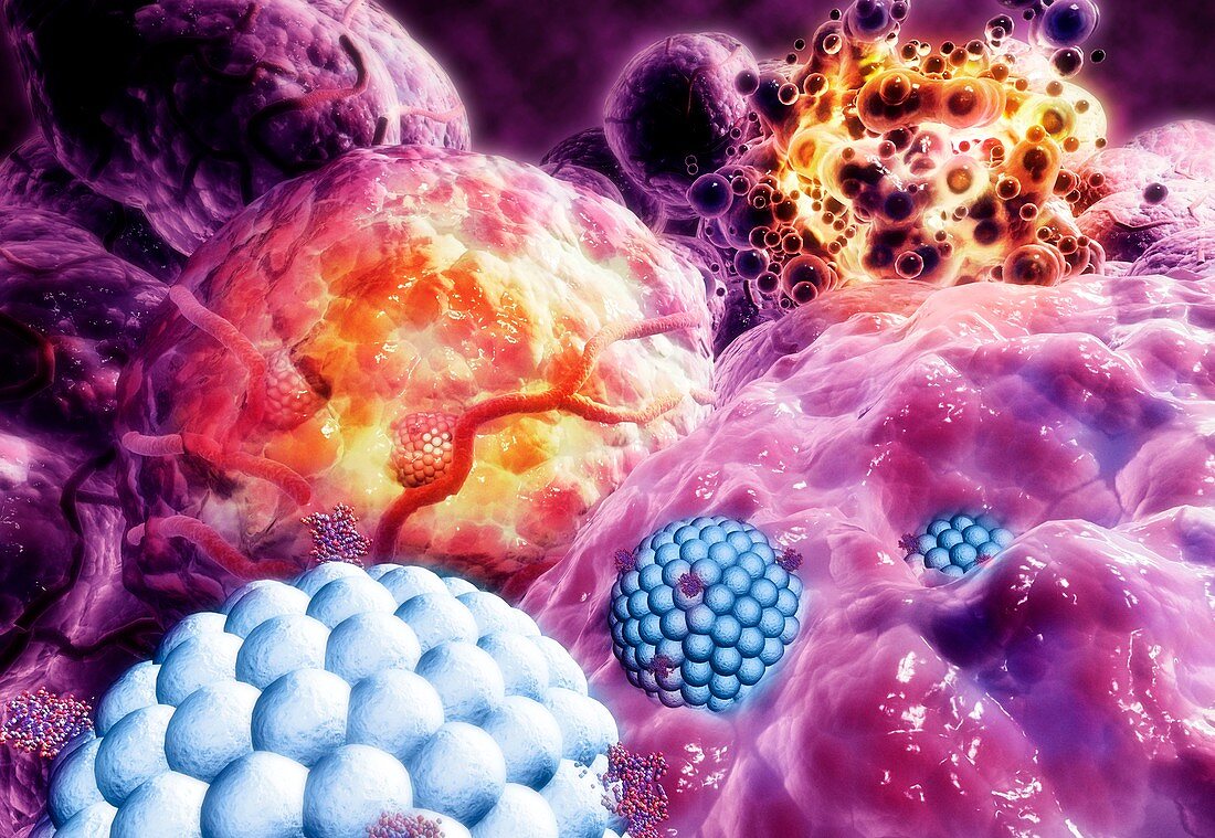 Nanoparticles destroying tumour,artwork