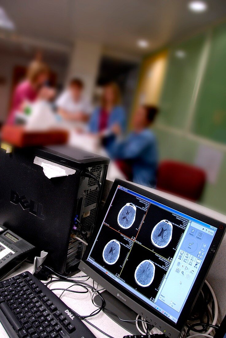 Monitor showing brain CT scan