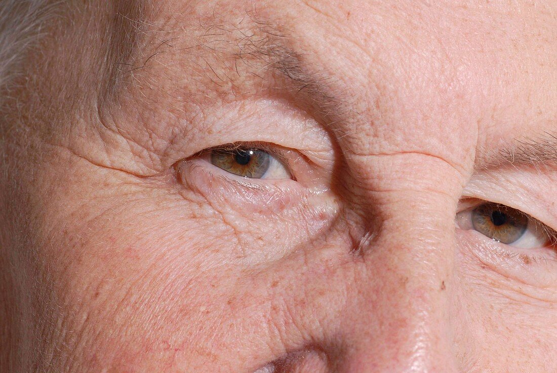 Elderly person's eyes